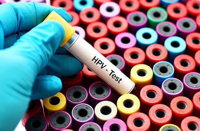 Кръвен тест за човешки папиломен вирус